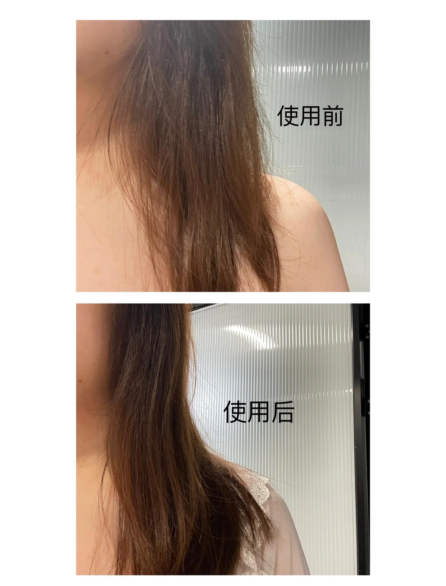 头发很油腻怎么解决