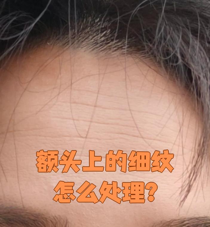 细纹形成后还能恢复吗